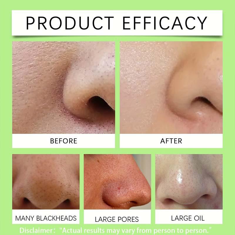 SJOPA 50 Piece Nose Strips Charcoal Cleansing Strips for All Skin Types Men Women Aloe Vera Enriched Scented Daily Soothing Aroma Acne Care