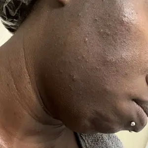 [medicube] Red Succinic Acid Panthenol Pads |  Niacinamide + Salicylic Acid Skincare