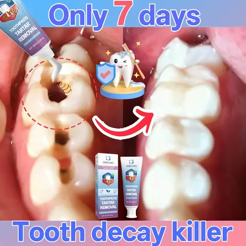 ZKRICARO Cavity Repair Toothpaste - Repair Hole, Strengthen Enamel, Removes Plaque, Relieves Sensitivity, Fresh Breath, Promotes Oral Health, High-Tech Microencapsulation, Gentle & Non-Irritating, Long-Lasting Protection