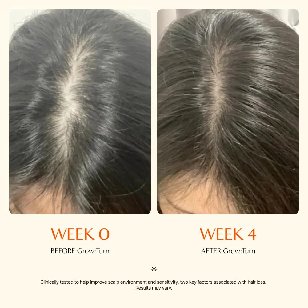 Lilyeve Growturn Hair Growth Serum with Built in Brush for Hair Growth & Thickening