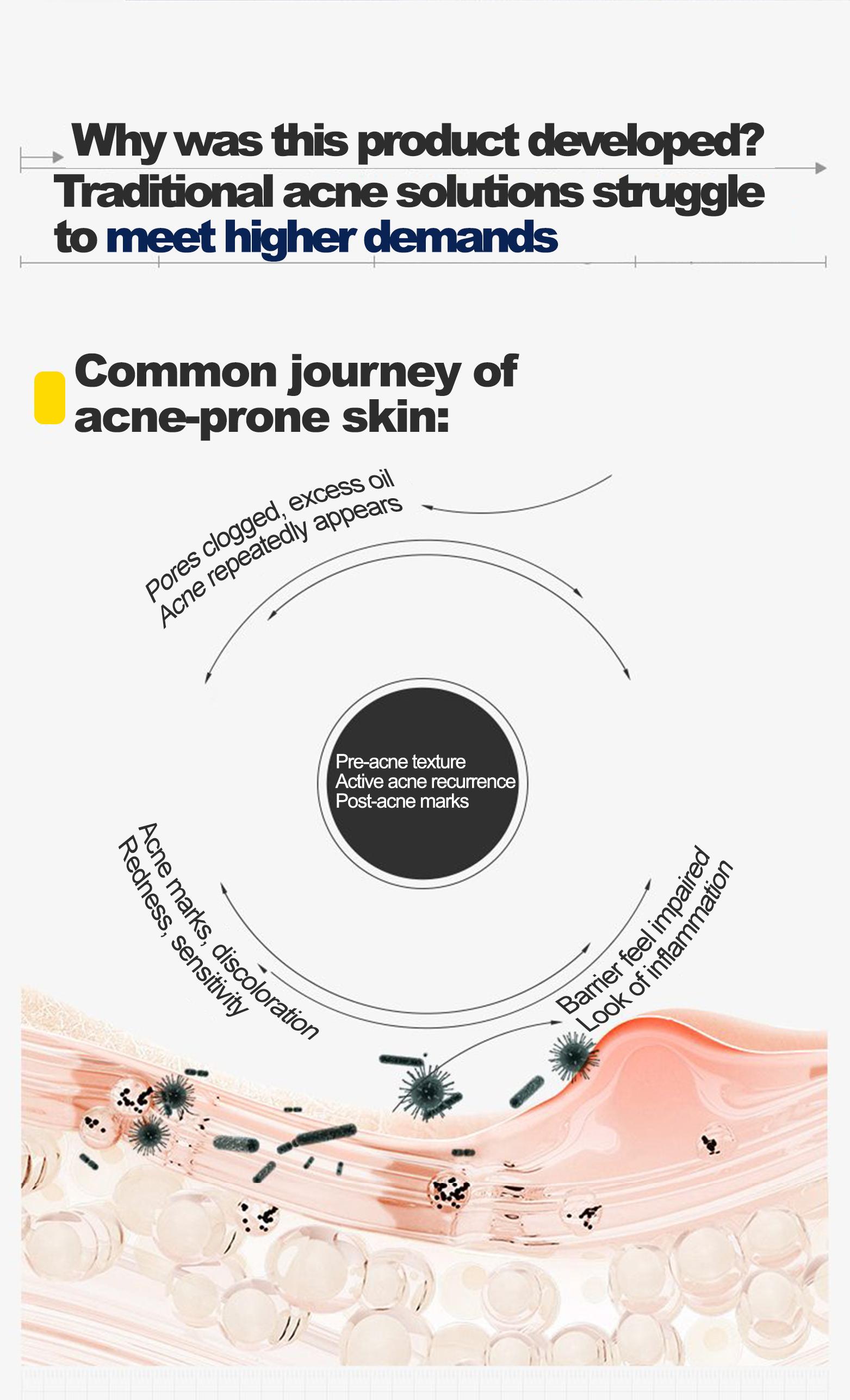 DR.MOPICK 24H Acne Care Essence, Clears Blemishes & Refreshes Skin By Day, Soothes & Prevents Breakouts By Night