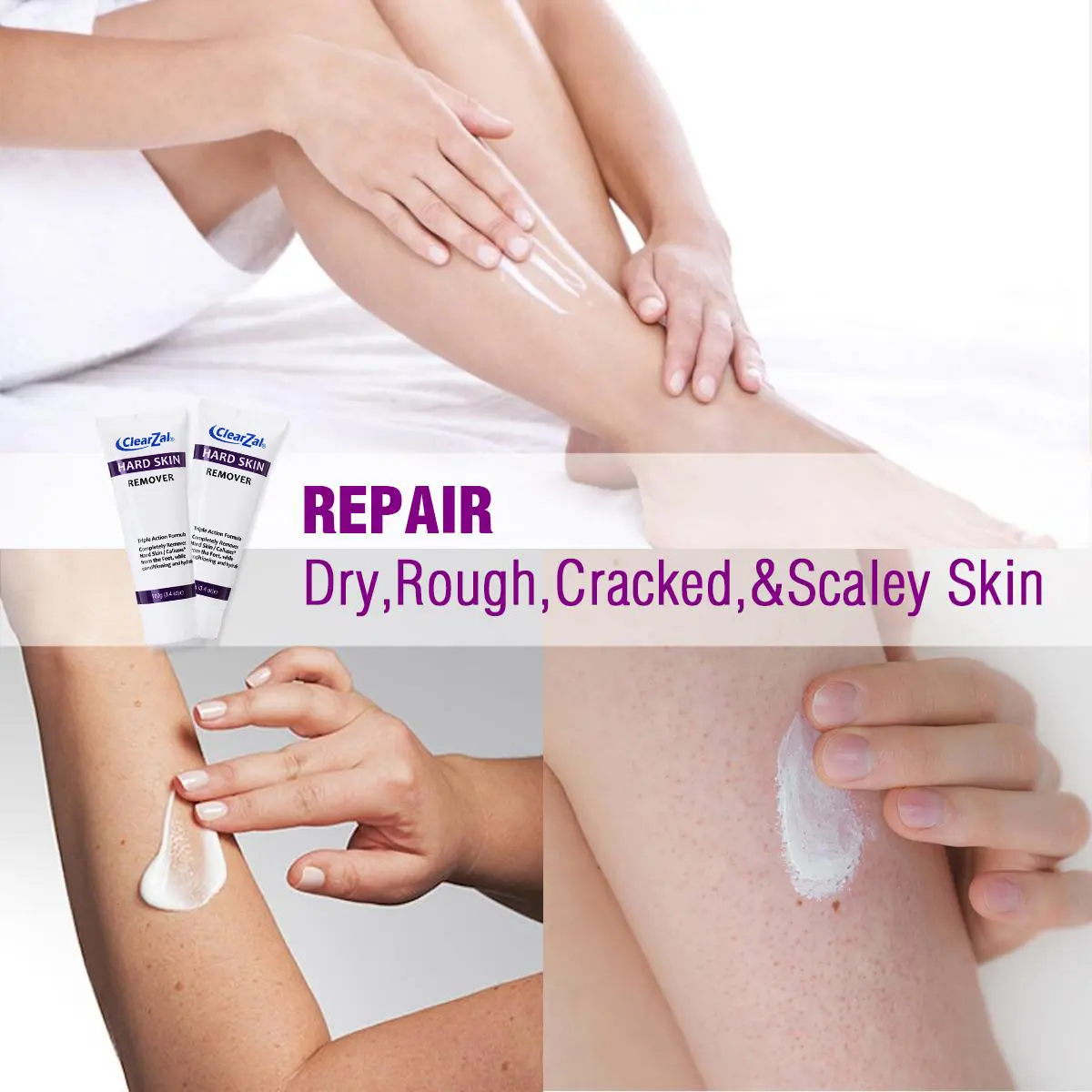 ClearZal targets chicken skin on arms and legs and enlarged pores,  improves it, and can be used all over the body Triple action formula exfoliates old skin cells 3.4 Ounce
