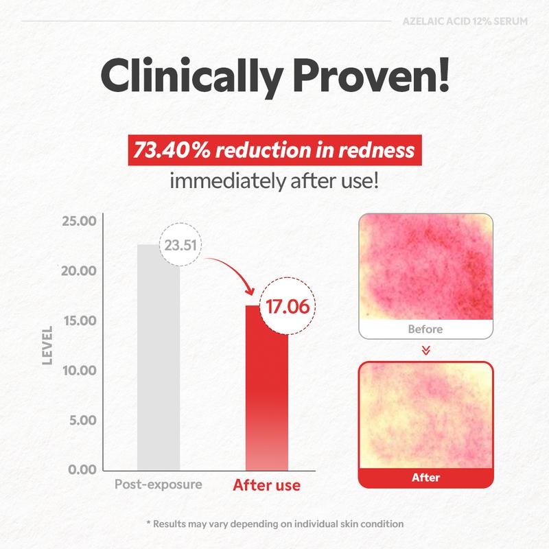 [TIRTIR Official] Azelaic Acid 12% Serum - Lightweight Dark Spot Reducer, Gentle Breakout care, For Uneven skin tone, Redness, Red Marks and Acne