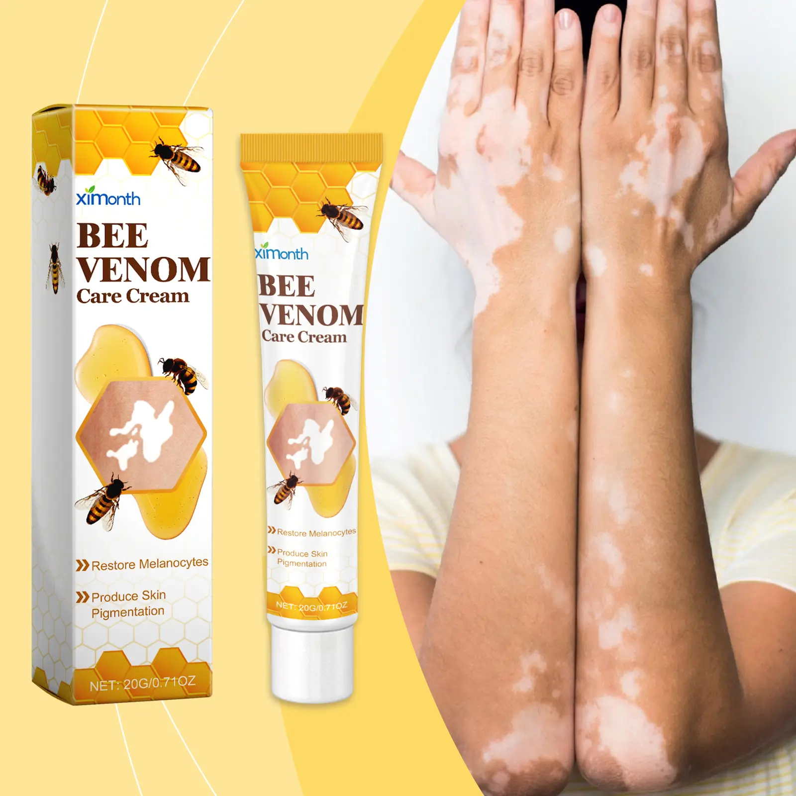 Ximonth Vitiligo Care Cream with Bee Venom & Vitamin C, Topical Repair for White Patches & Dark Spots, Organic Herbal Body Care Ointment for Adults, 20g