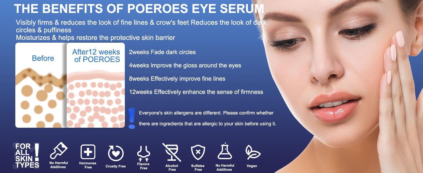 POEROES Caffeine Eye Serum & Cream Roller with 360° Massage Ball - Sensitive Skin Hydrating Moisturizer, Dark Circles Treatment, Barrier Repair for Puffiness, Wrinkles, Fine Lines (Hyaluronic Acid Blend) POEROES Caffeine Eye Serum & Cream Roller with 360° Massage Ball - Sensitive Skin Hydrating Moisturizer, Dark Circles Treatment, Barrier Repair for Puffiness, Wrinkles, Fine Lines (Hyaluronic Acid Blend)