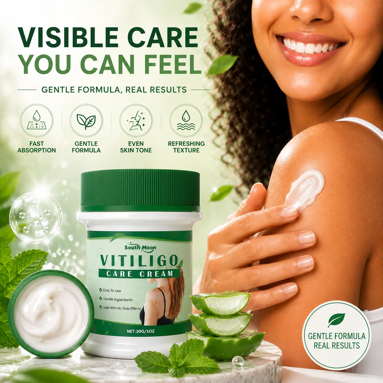 South Moon Gentle Vitiligo Treatment Cosmetic Cream - Natural Non-Toxic Blend, Hydrating Body Moisturizer for Skin Repair, Pigmentation Improvement, Suitable for All Skin Types