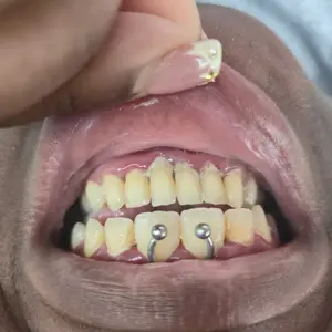 Glam Goddess Rechargeable Electric Teeth Cleaning Tool with Replacement Heads & Manual Auxiliary Cleaning Tools, Oral Irrigator for Home Use, Tartar Remover for Teeth,Remover Teeth Cleaning Kit