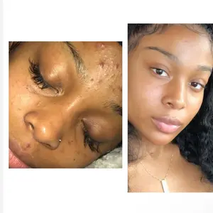 Strawberry purée scrub For  All Skin Types Organic Body Care Acne Gentle Nourishing Smooth Skin Repair relief cream smoother skin nourish your