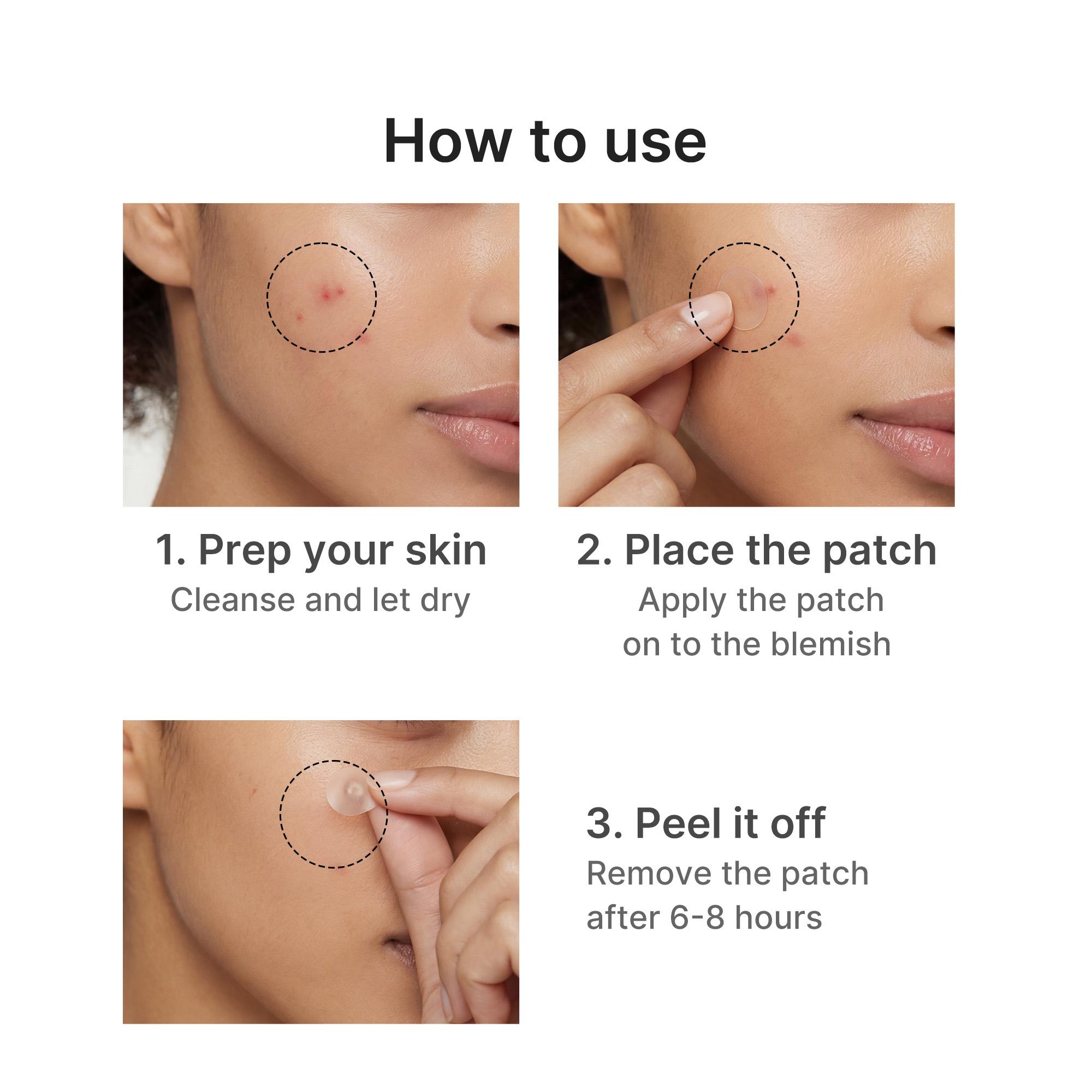 [NEW] [medicube] S.O.S Invisible Patch | Ultra-Thin Hydrocolloid Patch | Spot Care with Salicylic Acid, Tea Tree Oil | Invisible Cover, Absorbs Gunk, Non-Comedogenic Tested | Korean Skincare, 36 Count