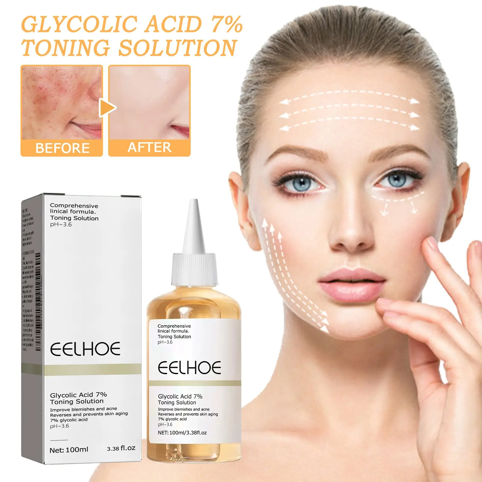 Eelhoe 7% Glycolic Acid Toner, Acne Treatment, Pimple Repair, Moisturizing Skin Care, Hydrating Facial Water, Anti-Acne Skincare