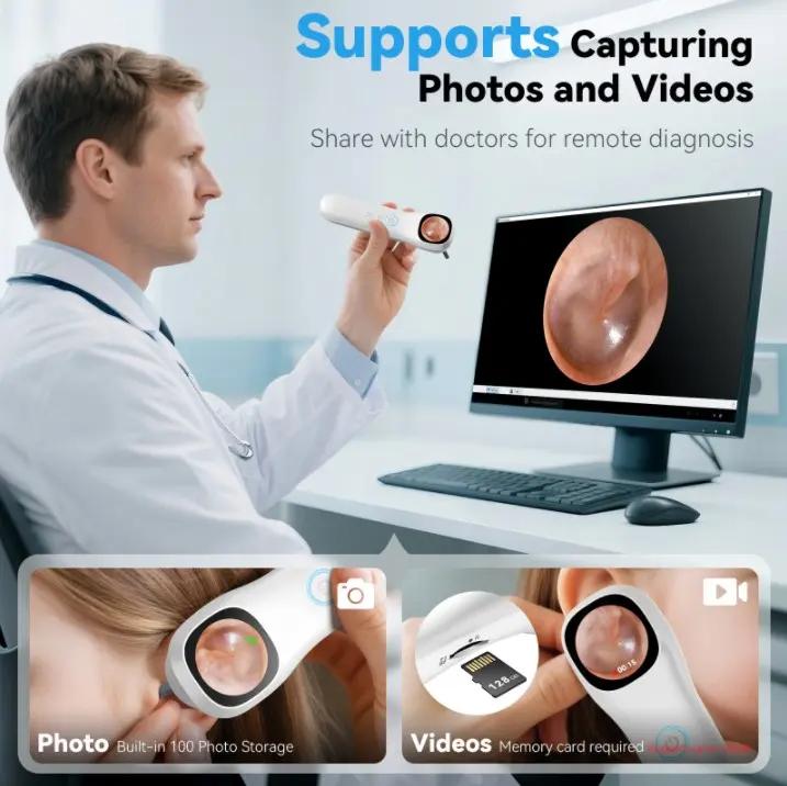 1080P HD Visual Ear Cleaner, 5-in-1 Smart Ear Detector with Built-in IPS Screen, Plug-and-Play Video Otoscope for Ear, Nose, Oral & Skin Observation