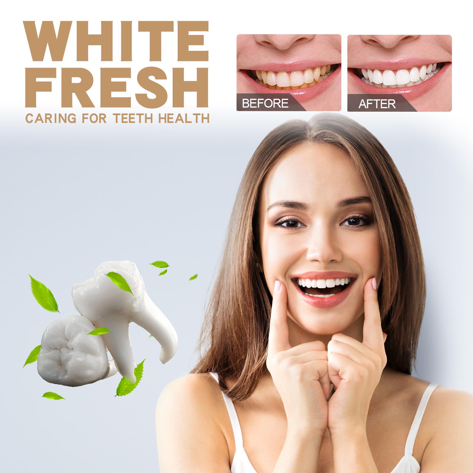 EELHOE Probiotic Whitening Toothpaste Removes Tooth Odor And Protects The Mouth. It Is A Daily Teeth Cleaning And Brightening Care Toothpaste