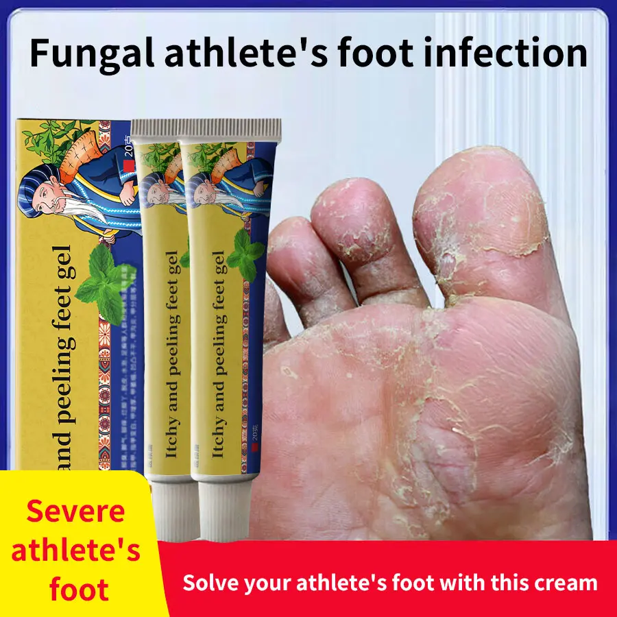 Miao's Athlete's Foot Cream: Relieves itching, removes peeling, kills fungi, stops foot itch, deodorizes, repairs cracked feet, treats blisters between toes and eliminates foot odor.