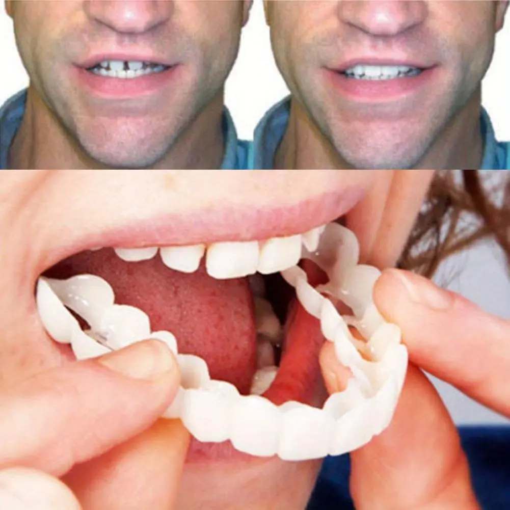 temporary caps Oral