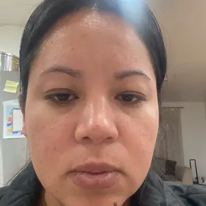 Product Review of NIDA Youthful Formula Ultimate Moisturizing Cream (100mL) / Collagen, Niacinamide, Centella Asiatica, Hyaluronic Acid / Wrinkles, Dark Spots, Skincare Hydrating Daily Moisturizer Moisture Hydrate from v**6