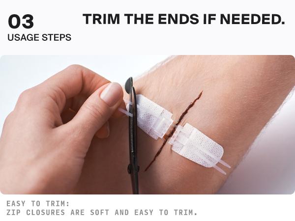 SURVIVEX Wound Closure Kit - Non-Invasive Skin Healing Solution for Cuts & Wounds - Gentle, Adjustable Tension, No Scarring, Easy Removal - All-in-One Emergency Healthcare Aid