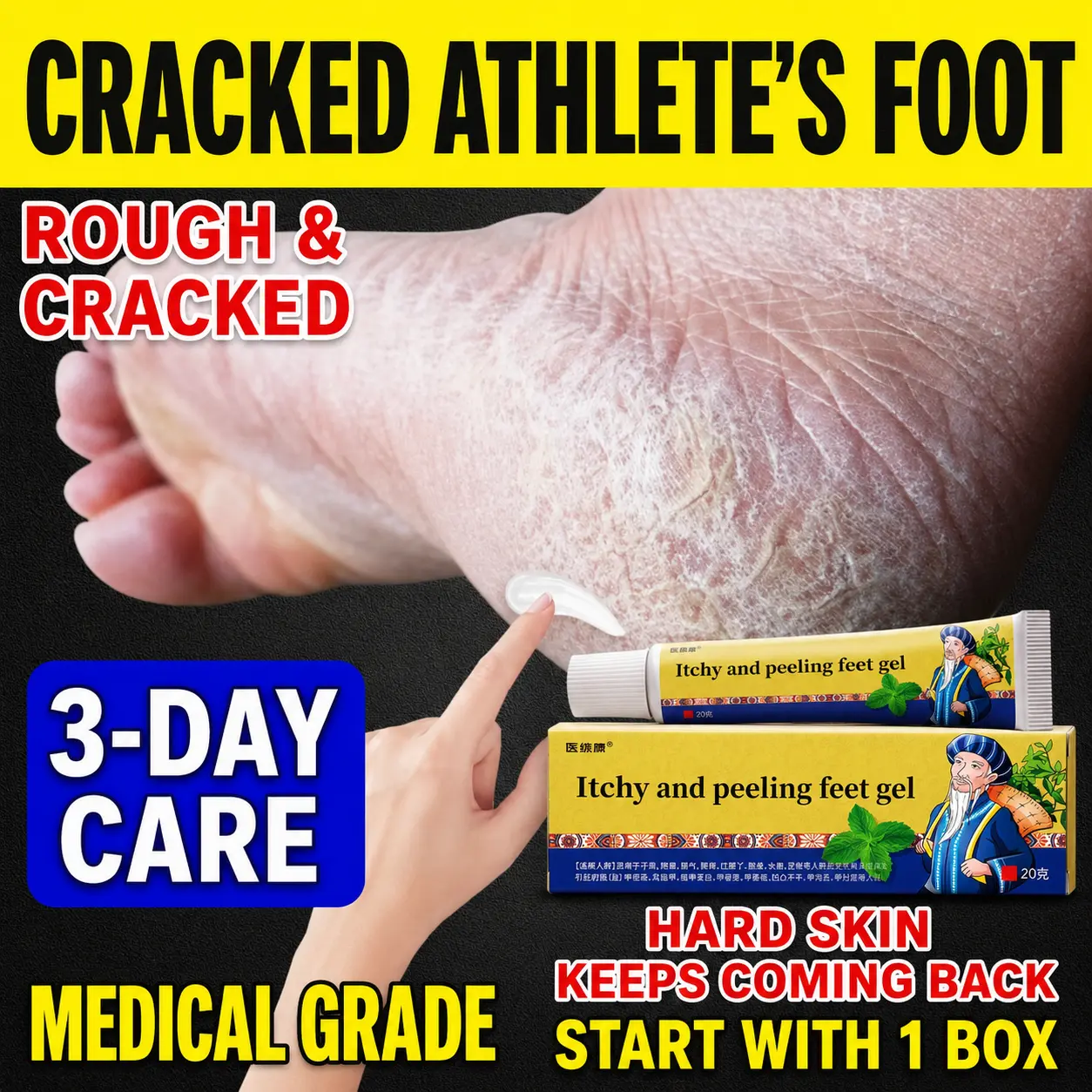 Household foot fungus care cream that soothes itching, relieves peeling, and eliminates foot odor; nourishes cracked and macerated toenails and interdigital spaces; herbal formula is gentle and antibacterial; quickly removes foot odors and itching; specif