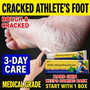 Home foot fungus care cream for soothing itching, reducing peeling and eliminating foot odor; repairs dry, cracked, and macerated skin between toes. Gentle herbal formula with antibacterial properties quickly removes foot odor and itching, relieving persi