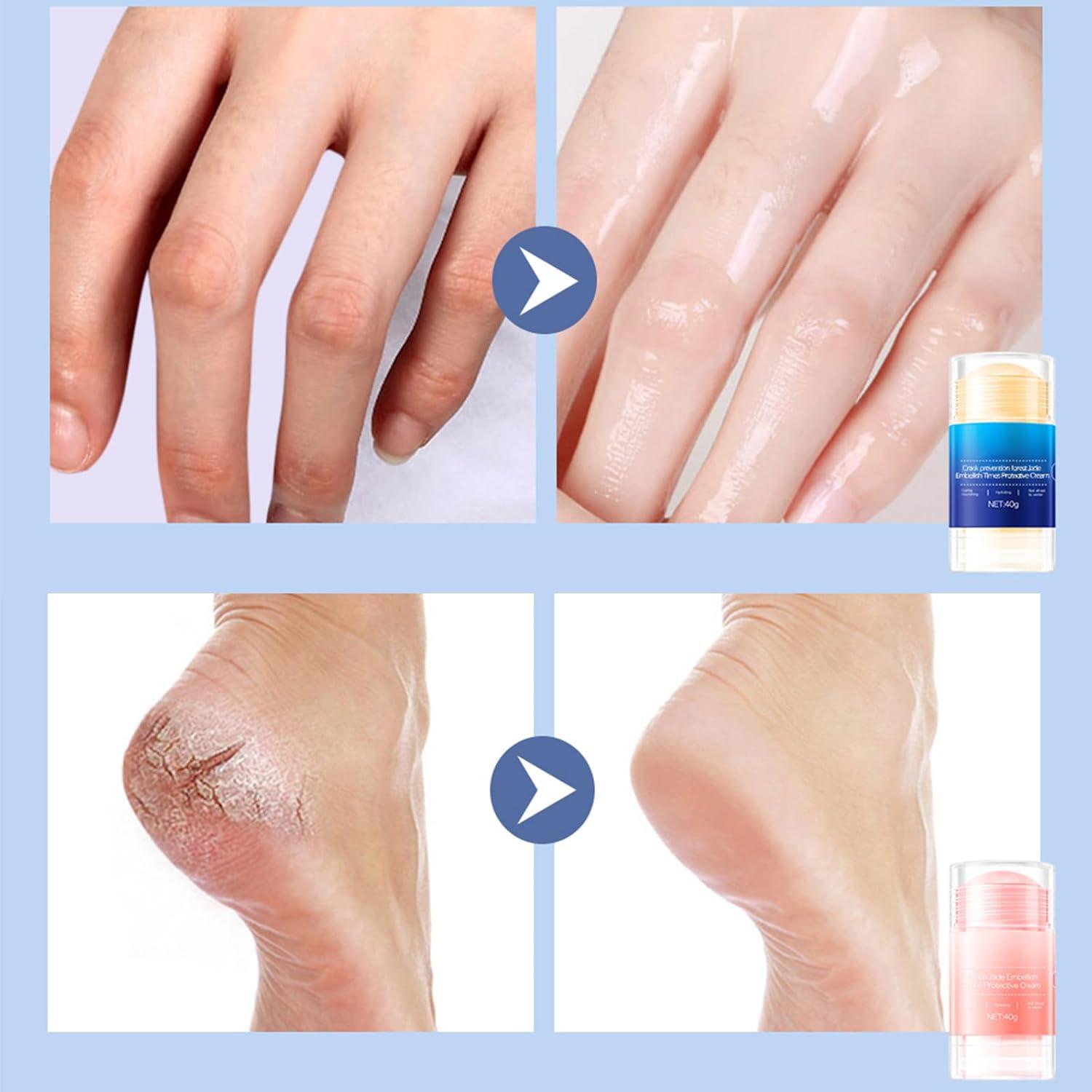 Feet Cracking Prevention Stick,Anti-Cracking Foot & Hand Cream Moisturizer for Dry Cracked Heel Feet, Knee, Elbow, Foot Balm Stick for Callus Remover & Dead Skin Softener Feet Cracking Prevention Stick,Anti-Cracking Foot & Hand Cream Moisturizer for Dry Cracked Heel Feet, Knee, Elbow, Foot Balm Stick for Callus Remover & Dead Skin Softener