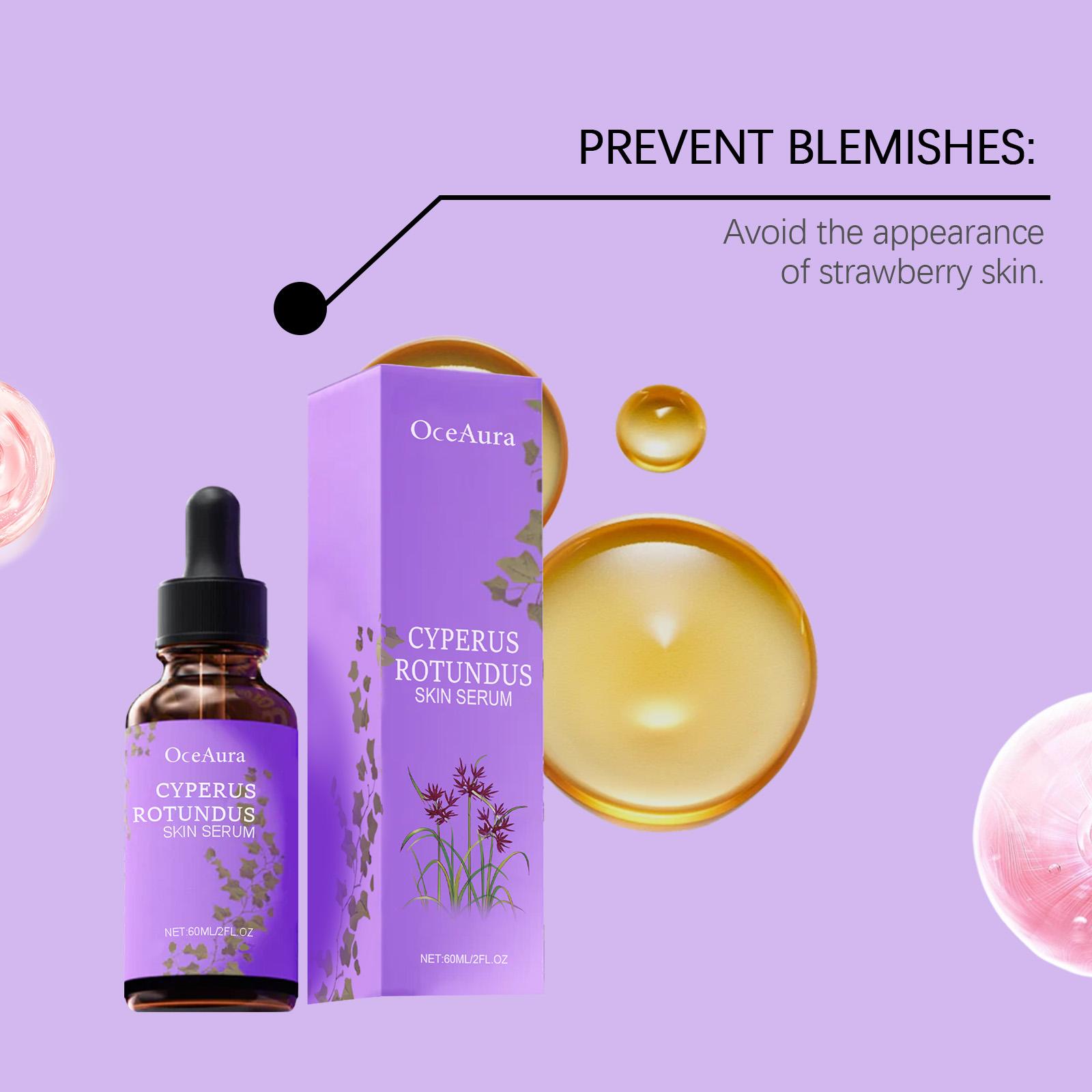 OceAura Cyperus Rotundus Oil Serum - Natural Hair Growth Inhibitor & Strawberry Legs Treatment - Post-Hair Removal Skin Repair Serum with Vitamin E & Olive Oil - Soothing & Hydrating for Sensitive Skin - 2 fl oz