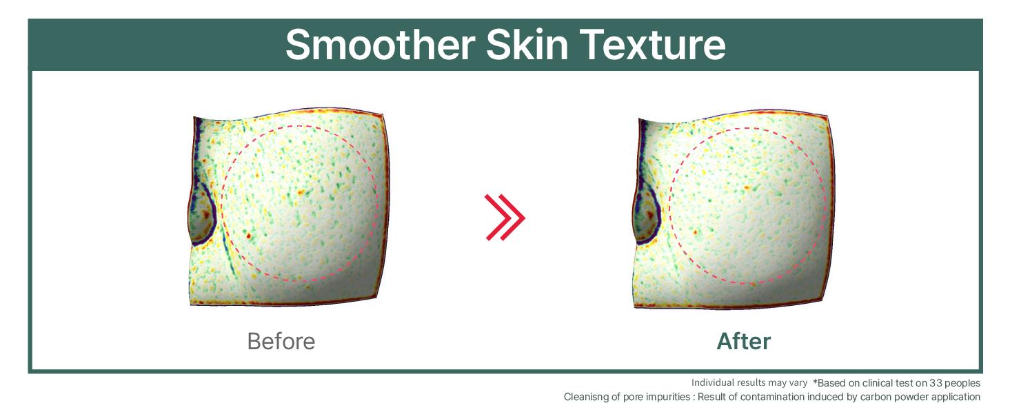 ILLIYOON Gentle Foaming Deep Facial Cleanser | Hypoallergenic & Sensitive Skin-Friendly, Cleanser for Dry and Acne-Prone Skin, Oil Control, Vegan-Certified, 8.45 fl. oz. (250ml) ILLIYOON Gentle Foaming Deep Facial Cleanser | Hypoallergenic & Sensitive Skin-Friendly, Cleanser for Dry and Acne-Prone Skin, Oil Control, Vegan-Certified, 8.45 fl. oz. (250ml)