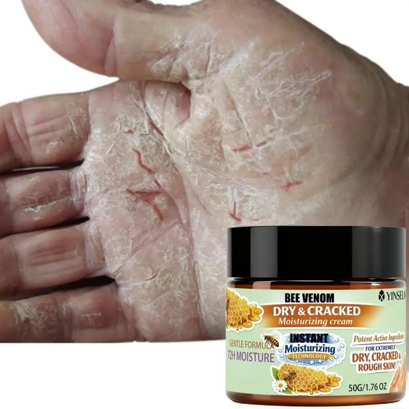Smooth Gentle Moisturizing Cream, Hand Moisturizer, Hydrating Hand Balm, 50g Bee Venom Dry Crack Relief, Instant Hydration, Long-Lasting 72hr Moisture, Hand Foot Body Use