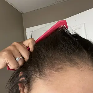 BASK AND LATHER Scalp Stimulator Hair Growth Oil - Lightweight Rosemary & Mint Blend for Thicker, Fuller Hair, Alopecia Support & Hair Regrowth