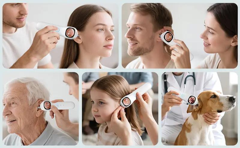 1080P HD Visual Ear Cleaner, 5-in-1 Smart Ear Detector with Built-in IPS Screen, Plug-and-Play Video Otoscope for Ear, Nose, Oral & Skin Observation