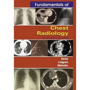 USED-Fundamentals of Chest Radiology (Fundamentals of Radiology) by Loren Ketai (Paperback)