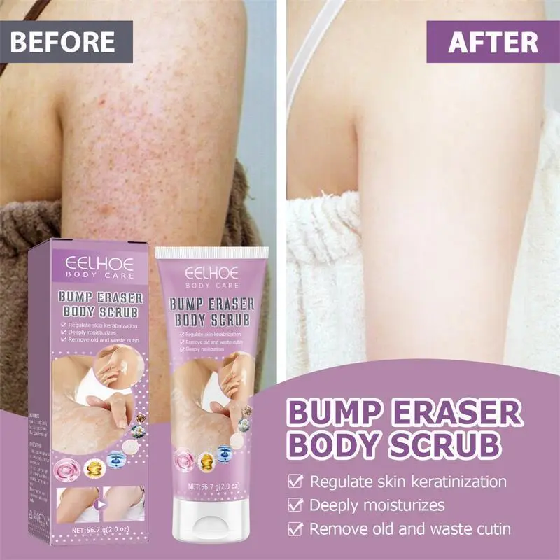 Skin Repair Body Lotion, An Exfoliating Body Care Treatment for Keratosis Pilaris, Chicken Skin Solutions for Strawberry Legs, KP Bumps & Dark Spots, Exfoliating Body Scrub