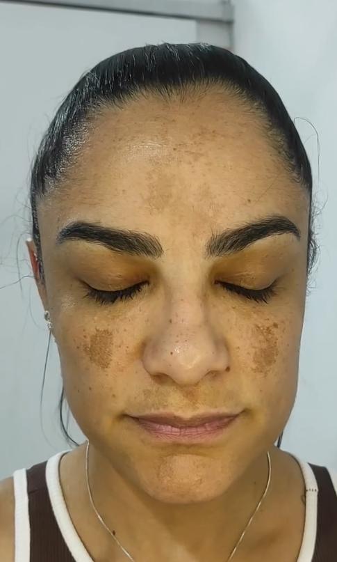 Item: 【6 Vials】50% off /15-day supply /Skin Firming