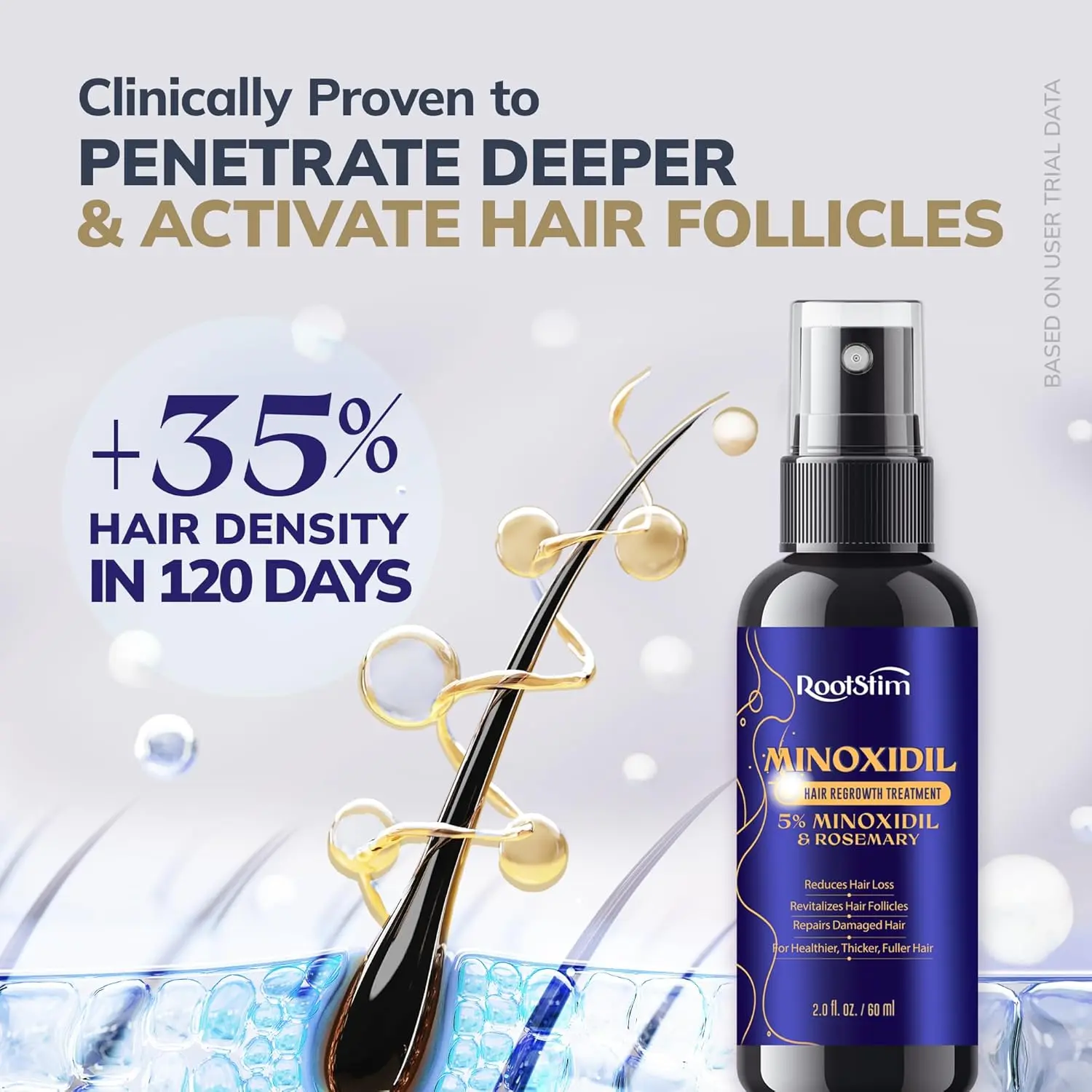 Rootstim 5% Minoxidil Hair Growth Serum with Hair Roller for Men & Women Ideal Gift for Mom Dad Him Boyfriend Husband Brother Birthday Daily Haircare