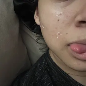 Product Review of Lion Pair Acne Cream Acne Treatment Pimples Removal Cream Pair Acne Creamy Foam Facial Wash Gentle Antibacterial from c**e