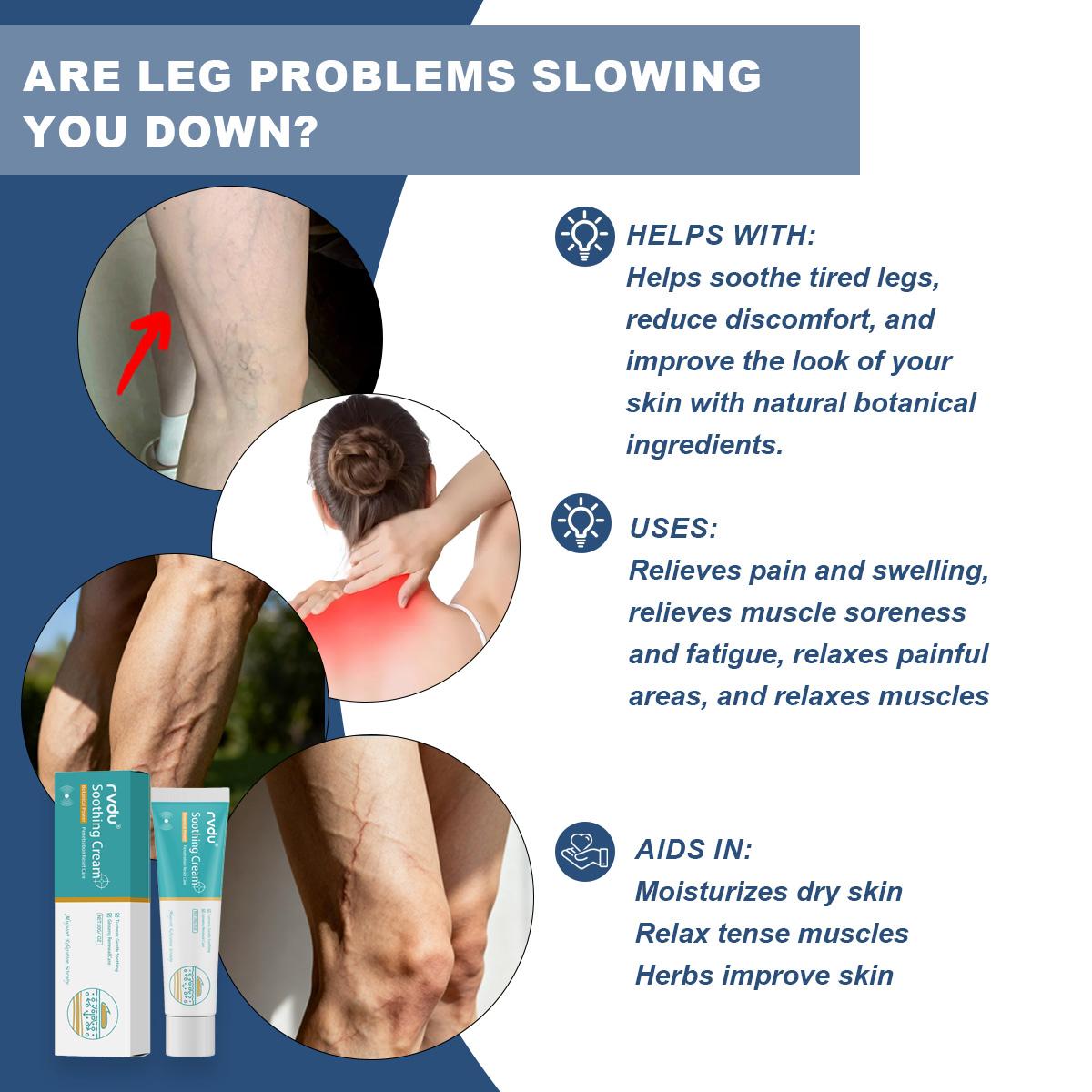 Herbal Varicose Veins Relief Cream[30g]ExternalUse for Pain, Swelling, and Vein Repair | Soothing MassageLotion for Body & SkinComfort