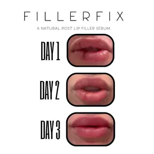 FillerFix Organic Lip Filler Aftercare — Botanical lip serum formulated with arnica, calendula & frankincense to soothe, nourish, and hydrate post-filler lips. Petroleum-free with a cooling ceramic applicator for a calming, spa-like feel. Made in the USA.