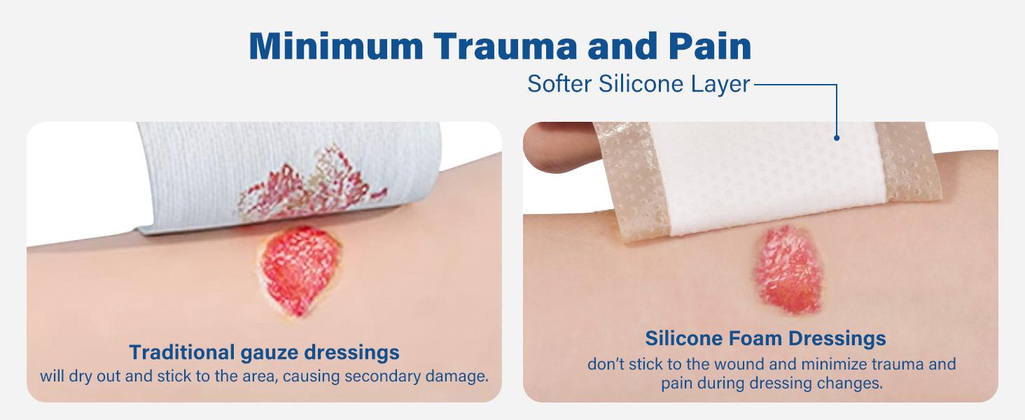 Silicone Foam Dressing with Border, 4"x 4" (2.5”x2.5” Pad), 5 Count, Sterile Adhesive Wound Dressing for Bed Sores, Leg Ulcers, Highly Absorbent, Waterproof Wound Care Bandage Silicone Foam Dressing with Border, 4"x 4" (2.5”x2.5” Pad), 5 Count, Sterile Adhesive Wound Dressing for Bed Sores, Leg Ulcers, Highly Absorbent, Waterproof Wound Care Bandage