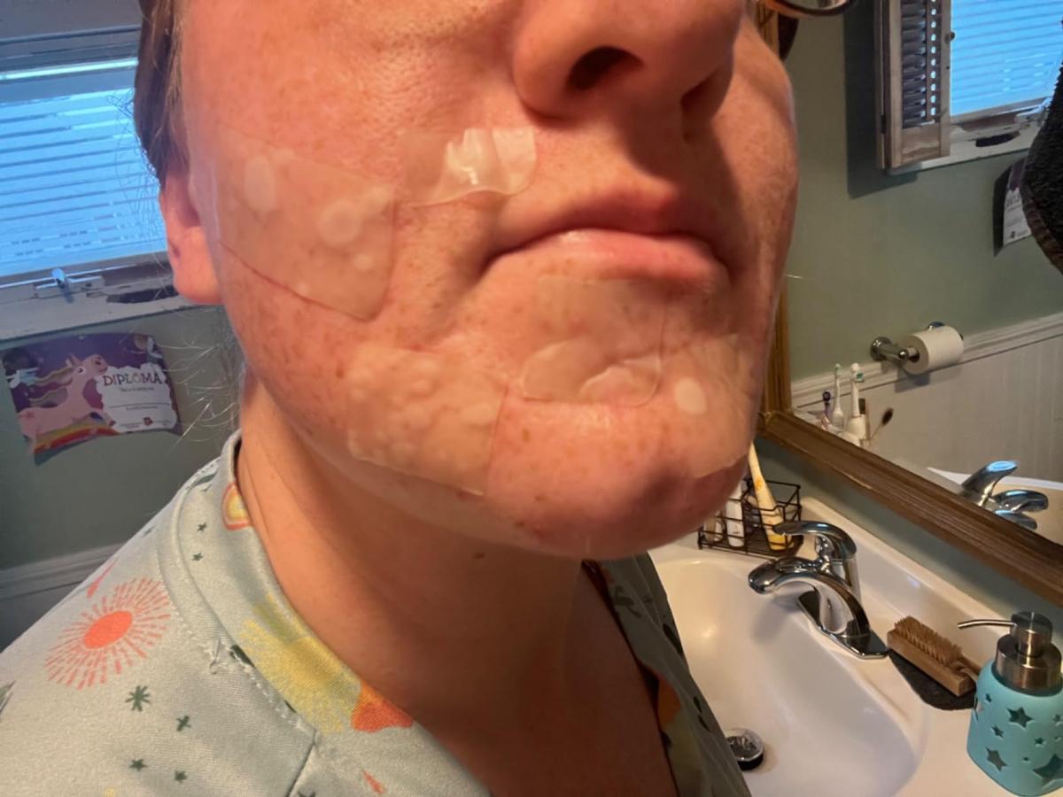 Item: 1pcs(3M) 50%OFF(HOT)