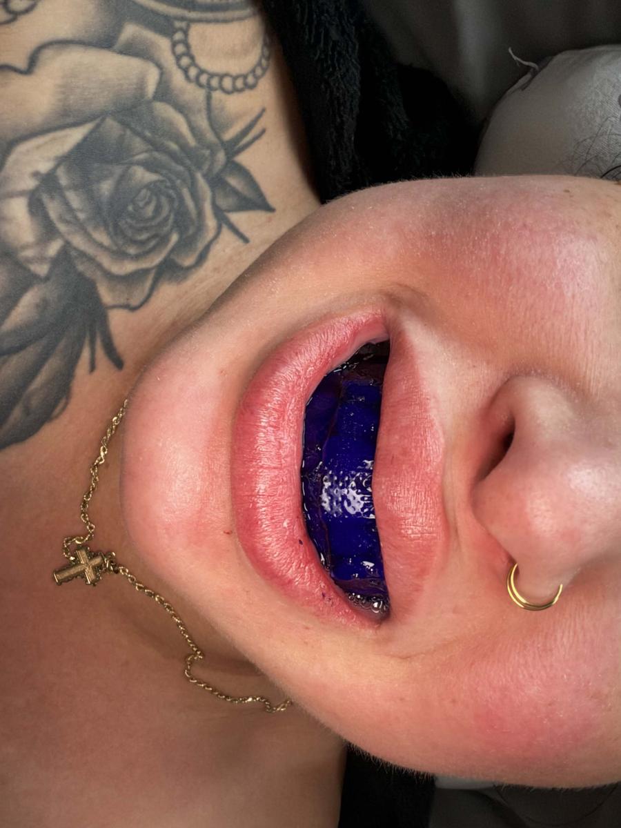 Item: 14 strips (7 sessions)