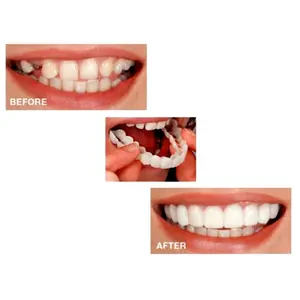 2pc, Dental Veneer Comfortable Fit Flex White Dentures Top Veneer Dentures Accessories For Men And Women