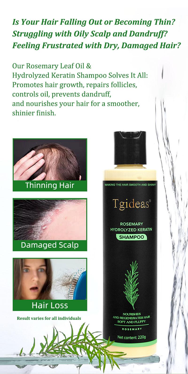Tgideas Rosemary Shampoo  - Promotes Hair Growth Controls Oil and Dandruff Soothes Scalp and Restores Shine!