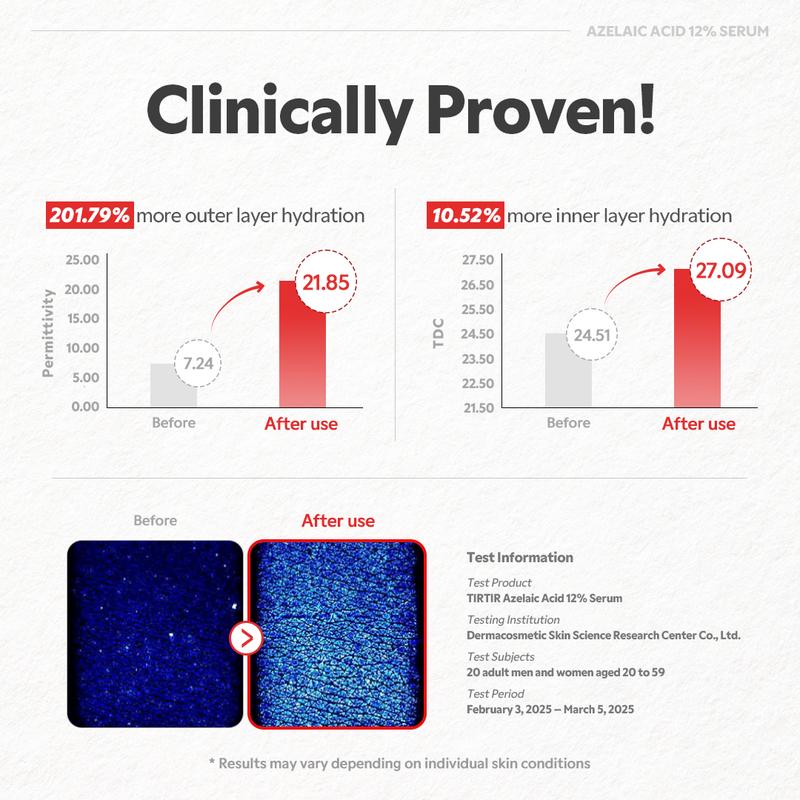 [TIRTIR Official] Azelaic Acid 12% Serum - Lightweight Dark Spot Reducer, Gentle Breakout care, For Uneven skin tone, Redness, Red Marks and Acne
