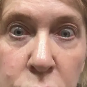 Product Review of Qure Micro-Infusion Anti Wrinkle Patches for Smile Line, Frown lines, Under Eye Bags, Puffiness, Crow's Feet - Retinol, Niacinamide, Caffeine, Peptides - Dissolvable for Overnight Use - 8 Pairs from W**a W**❌