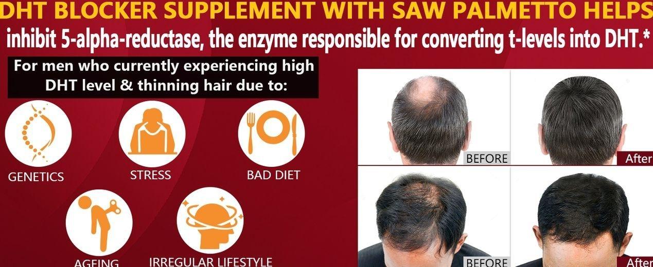 DHT Blocker for Men | Extra Strength Saw Palmetto & Biotin Hair Growth Supplement - Hair Growth Vitamins - Hair Regrowth - Natural Hair Loss Supplements for Men - Proprietary Herbal Blends,1 Pack
