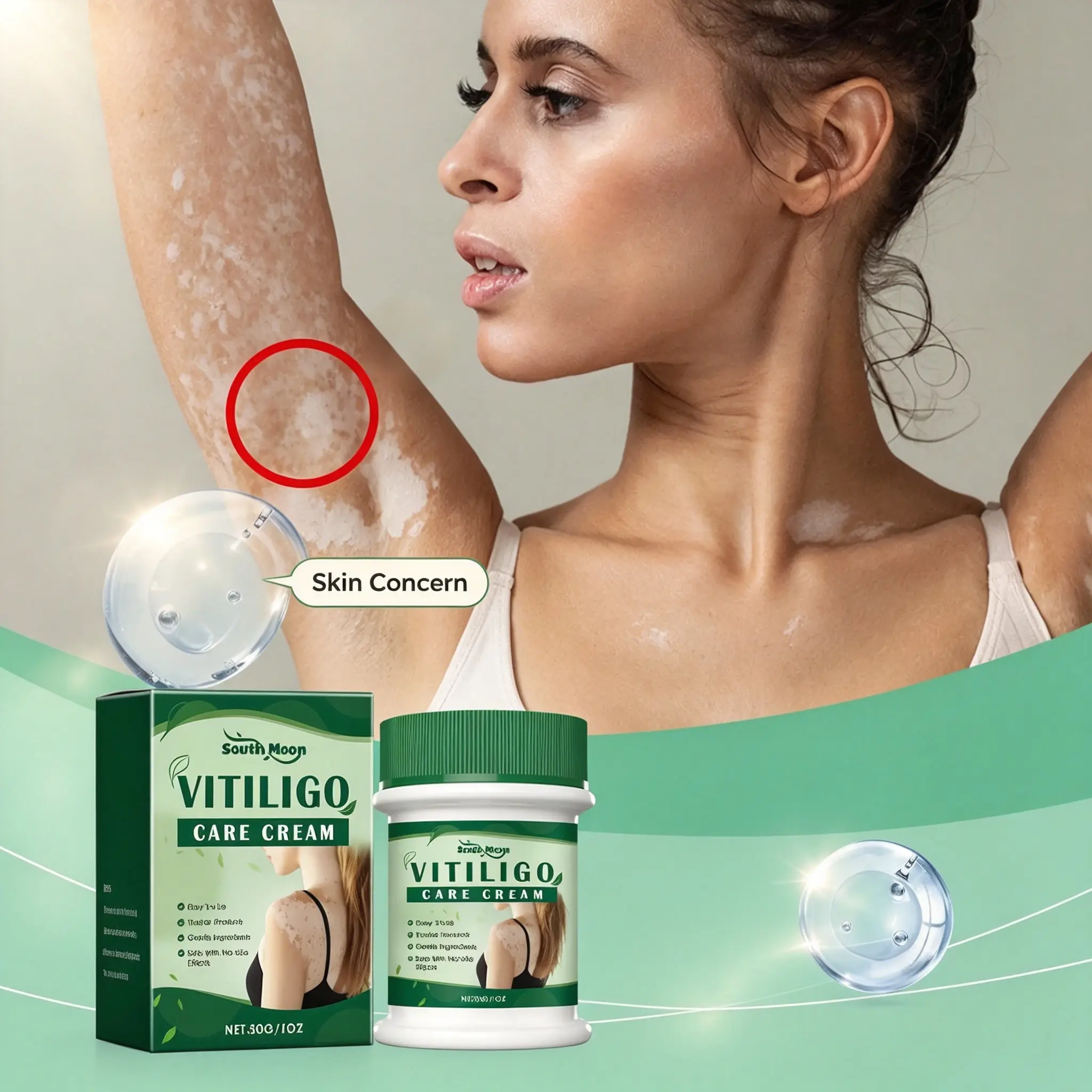 Natural Ingredients Vitiligo Treatment Cream, Easy to Use Skin Care Ointment for Body White Spots Help Restore Natural Skin Pigment