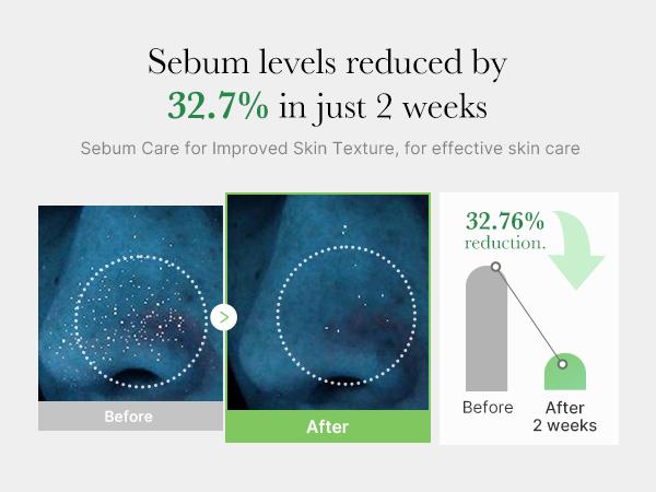 [Official Shop] Exosome Cica Toner | Daily Soothing Toner With Exosome Cica, Heartleaf, Tea Tree | Korean Skin Care for Stressed Skin