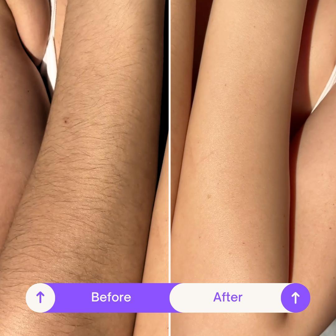 Flamingo 200ml Body Hair Removal Cream, Designed for Sensitive Skin, Unisex Gentle Formula, Smooth Results Last Up to 7 days, Body hair remover for women Flamingo 200ml Body Hair Removal Cream, Designed for Sensitive Skin, Unisex Gentle Formula, Smooth Results Last Up to 7 days, Body hair remover for women