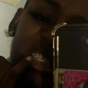 Neeyer 1000 Gems DIY Tooth Gem Kit, Fashion Teeth Jewelry Starter Kit