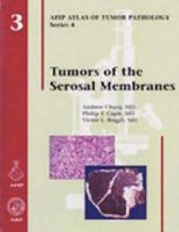 USED-Tumors of Serosal Membranes (Atlas of Tumor Pathology Series IV) by Andrew Churg (Hardcover)
