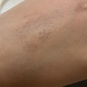 Product Review of Waterproof Freckles Pen: Faux Freckle Stamp and Fine Tip Eyeliner for Realistic, Long-Lasting Freckles and Effortless Makeup, Perfect for Daily Wear and Cosplay from 𝓘**)