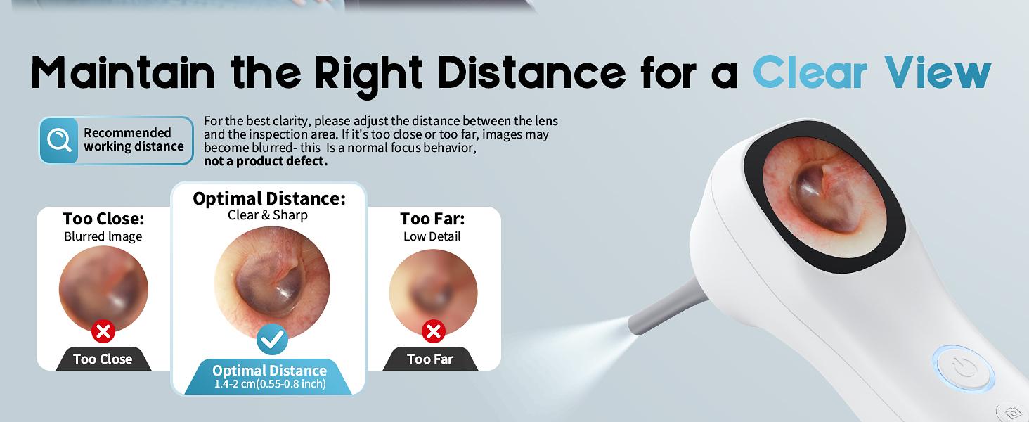 Otoscope Ear Camera with 1.21” Screen, 1080P Ear Scope with 4 LED Lights, Otoscope Camera for Adults Kids and Pets, Support Photo & Video, Type-C Charging with Computers, Baby Essentials, Home Medical